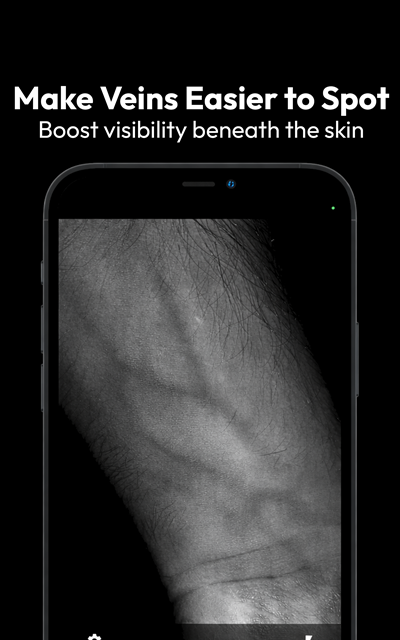 VeinExplorer app showing forearm veins