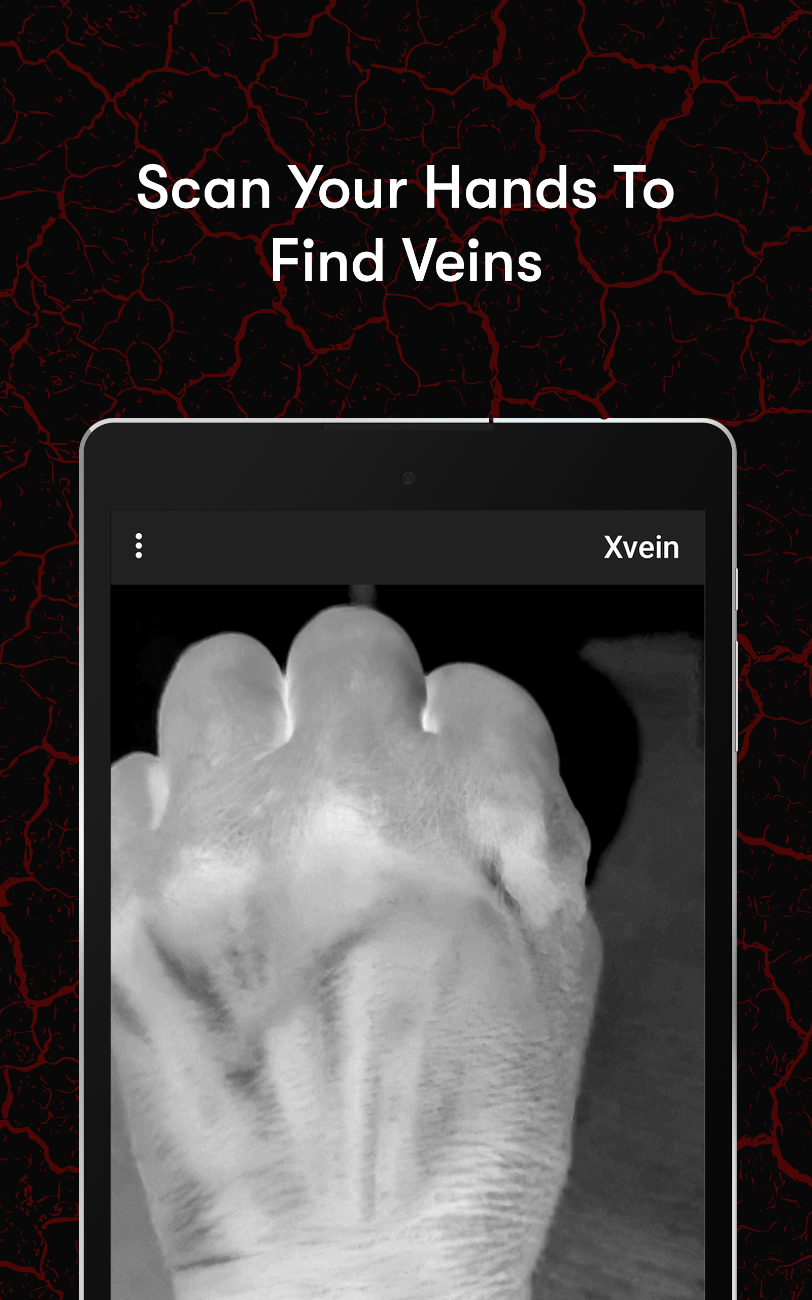 VeinExplorer app showing hand vein scan