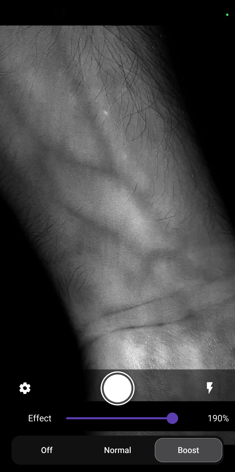 VeinExplorer app enhancing surface vein visibility on a forearm