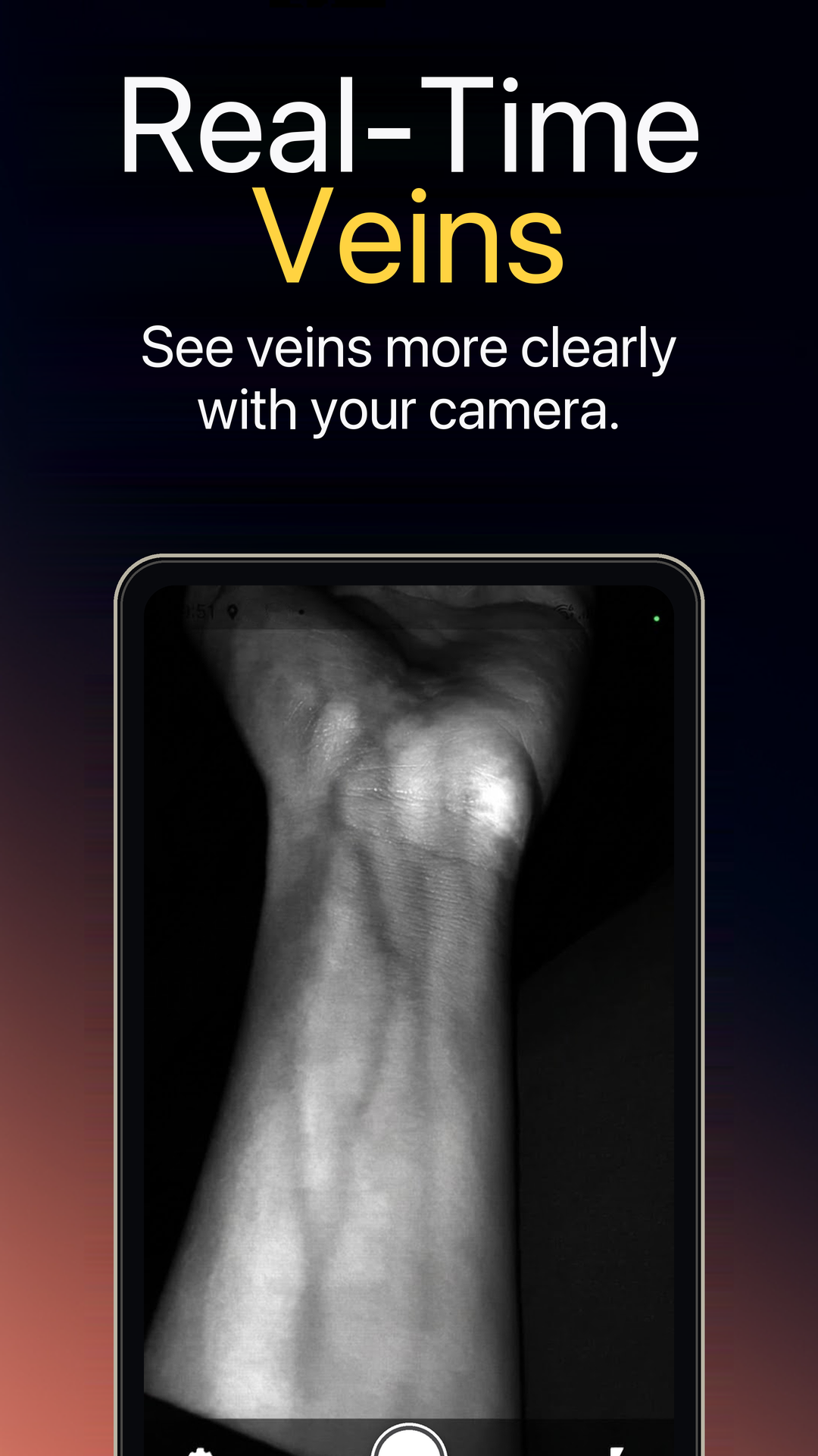 Real-time veins feature in VeinExplorer